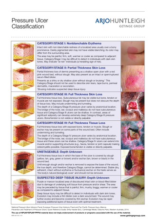 Pressure Ulcer Classification Guide