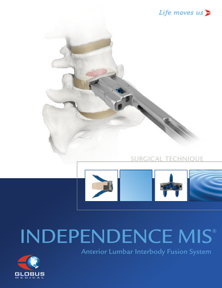 SURGICAL TECHNIQUE  INDEPENDENCE MIS  ®  Anterior Lumbar Interbody Fusion System  