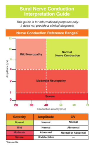 Sural Nerve Conduction Interpretation Guide This guide is for informational purposes only. It does not provide a clinical diagnosis. 1-5 Nerve Conduction Reference Nerve Conduction ReferenceRanges Ranges*  32  16  Normal Nerve Conduction  Amplitude (µV)  Mild Neuropathy 8  4  Moderate Neuropathy  2  1 Severe  0 20  30  40  50  60  Conduction Velocity (m/s)  Severity  Amplitude  CV  Normal  Normal  Mild  Normal  Abnormal  Moderate  Abnormal  Normal or Abnormal  Severe  Undetectable  ----  Normal  *Data on file  70  