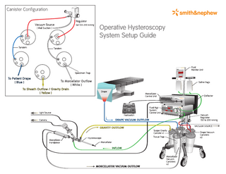 Hysteroscopy System Setup Guide Rev A May 2020