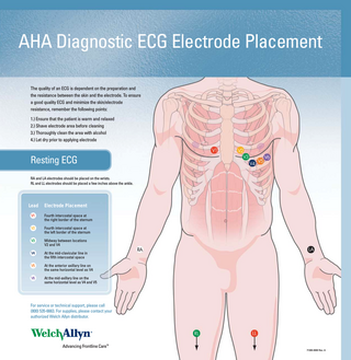 AHA Diagnostic ECG Electrode Placement The quality of an ECG is dependent on the preparation and the resistance between the skin and the electrode. To ensure a good quality ECG and minimize the skin/electrode resistance, remember the following points: 1.) Ensure that the patient is warm and relaxed 2.) Shave electrode area before cleaning 3.) Thoroughly clean the area with alcohol 4.) Let dry prior to applying electrode  Resting ECG RA and LA electrodes should be placed on the wrists. RL and LL electrodes should be placed a few inches above the ankle.  Lead  Electrode Placement  V1  Fourth intercostal space at the right border of the sternum  V2  Fourth intercostal space at the left border of the sternum  V3  Midway between locations V2 and V4  V4  At the mid-clavicular line in the fifth intercostal space  V5  At the anterior axillary line on the same horizontal level as V4  V6  At the mid-axillary line on the same horizontal level as V4 and V5  For service or technical support, please call (800) 535-6663. For supplies, please contact your authorized Welch Allyn distributor.  Advancing Frontline Care™ 71300-0000 Rev. A  